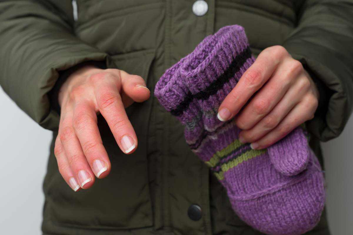 Patologie collegate alle mani fredde